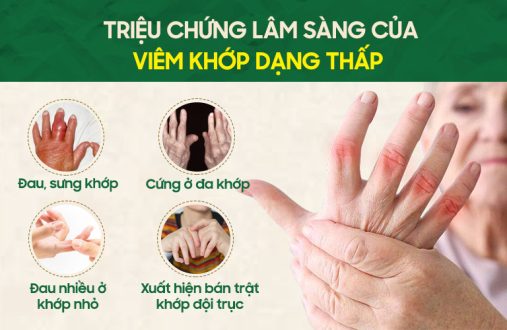 Triệu chứng điển hình của viêm khớp dạng thấp