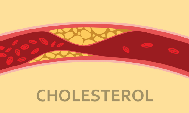 High blood cholesterol and potential dangers