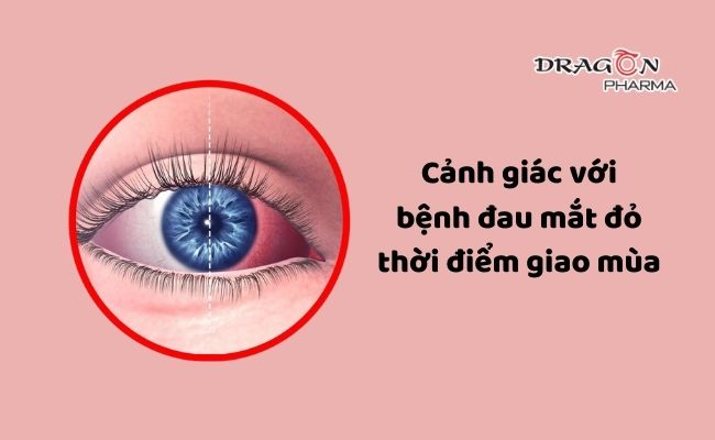 Cảnh giác với bệnh đau mắt đỏ thời điểm giao mùa